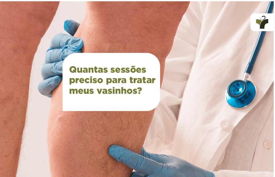 Quantas sessões preciso fazer para tratar meus vasinhos