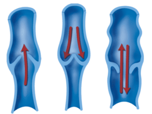 FAQ - Refluxo Venoso Dr. Arlei